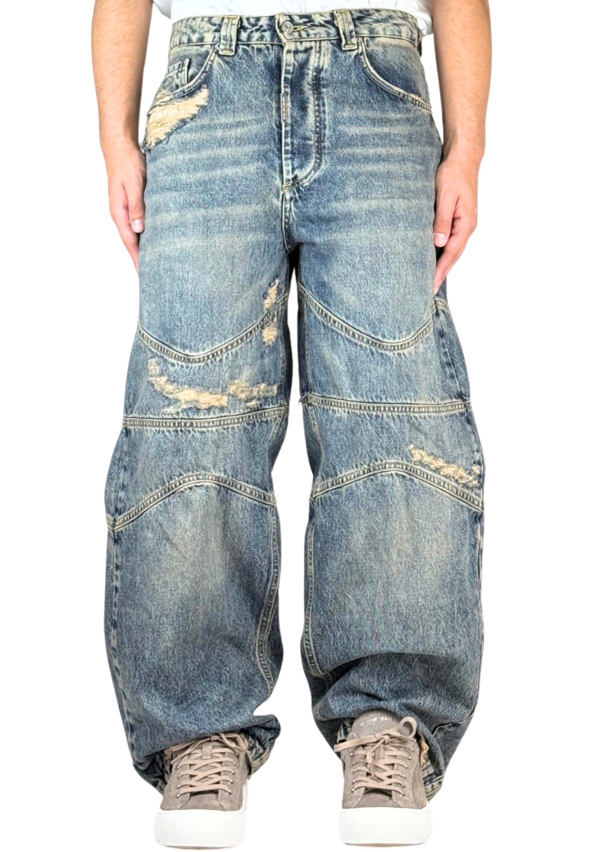 SAND BAGGY ABRASIONS DIAGONAL CUTS